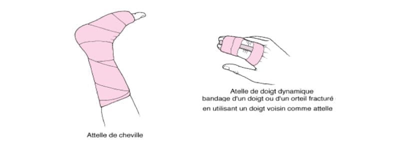 immobilisation membres inférieurs attelle de cheville doigt bandage